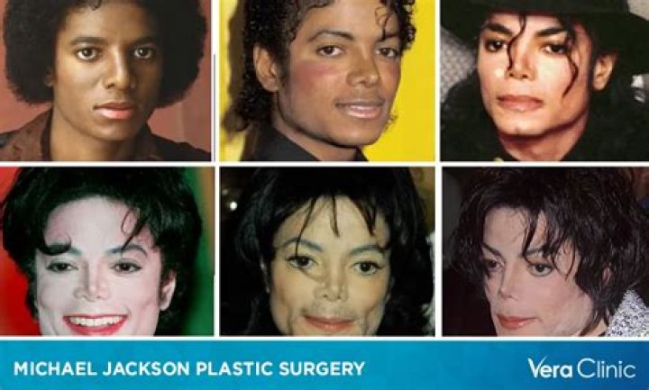 Michael Mone Plastic Surgery: Estimation of The Procedures She Underwent to Get That Glam Look!